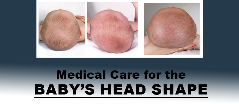 Head flatness hot sale in babies