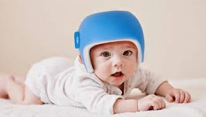 Cranial Helmets for Babies