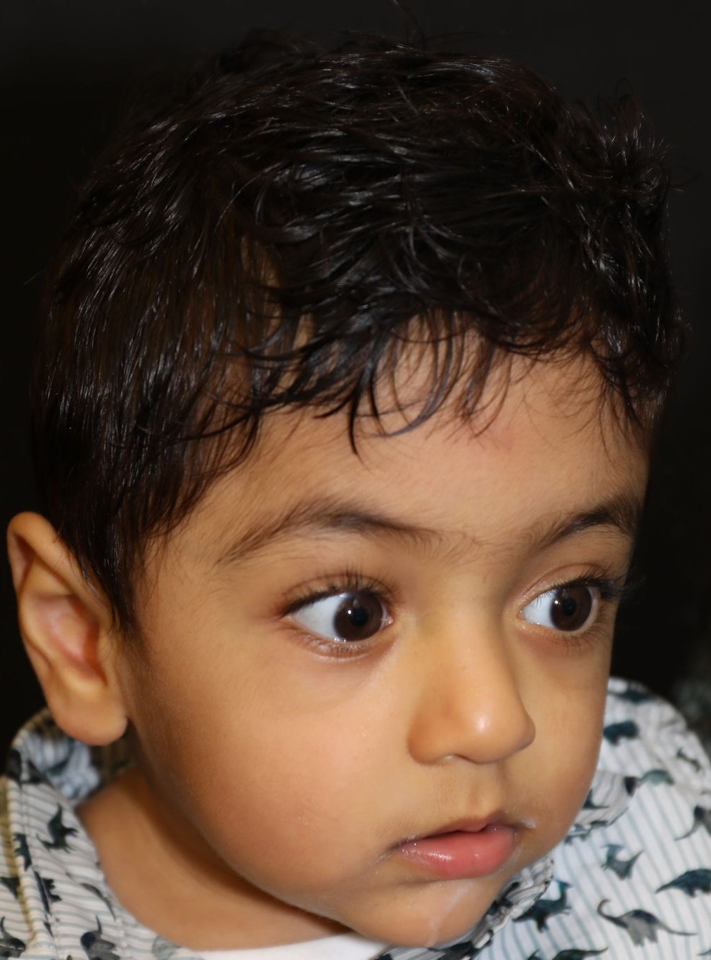 Right angle at Year 3 after treatment - Case 1009