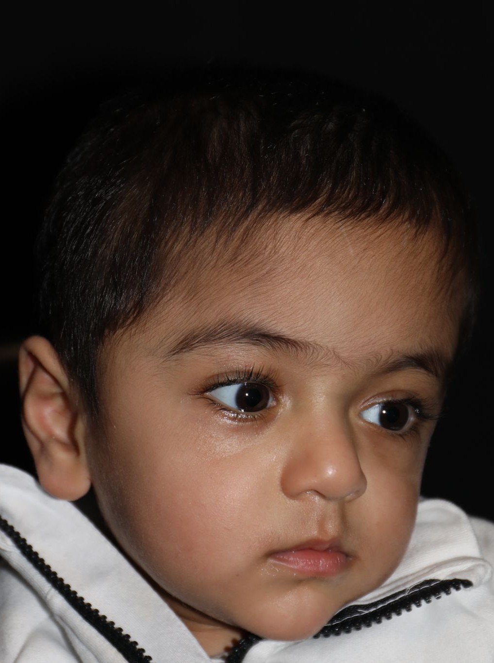 Right angle at Year 2 after treatment - Case 1009