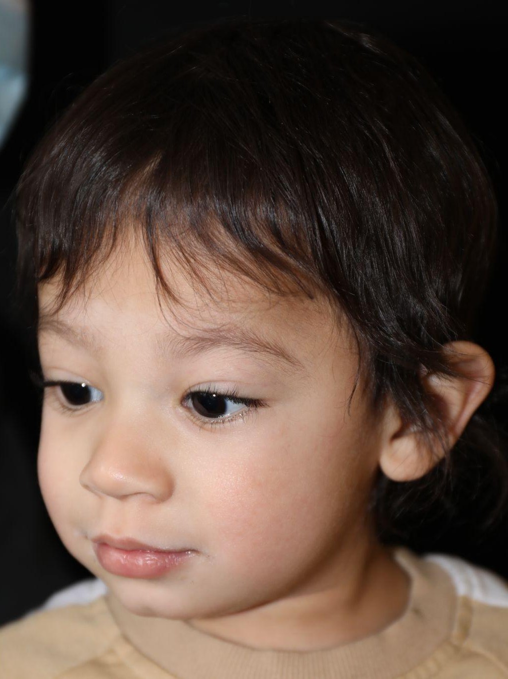 Left angle at Year 3 after treatment - Case 1004