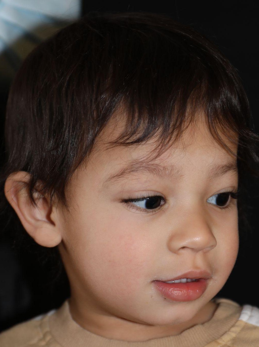 Right angle at Year 3 after treatment - Case 1004