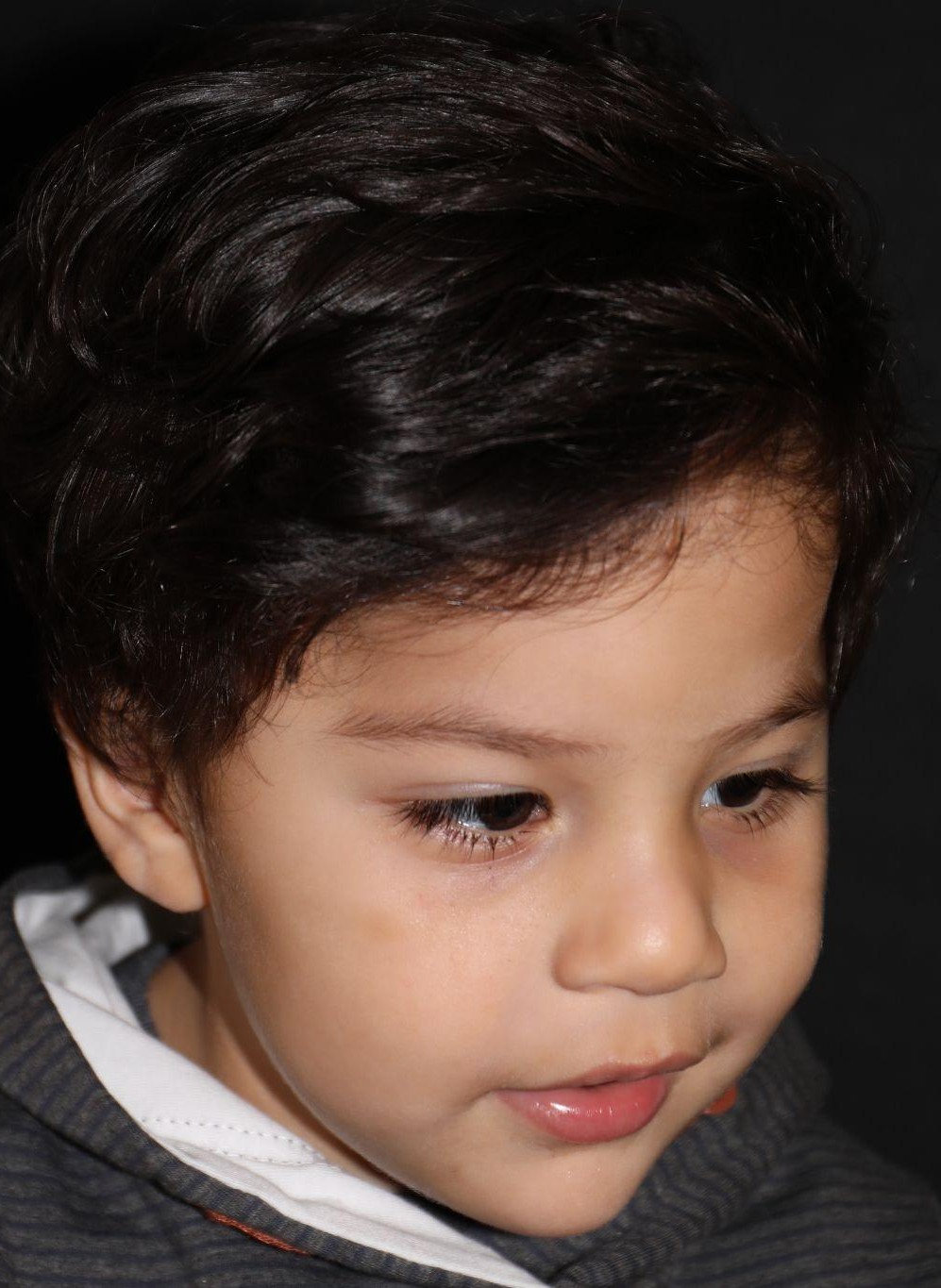 Right angle at Year 3 after treatment - Case 1006