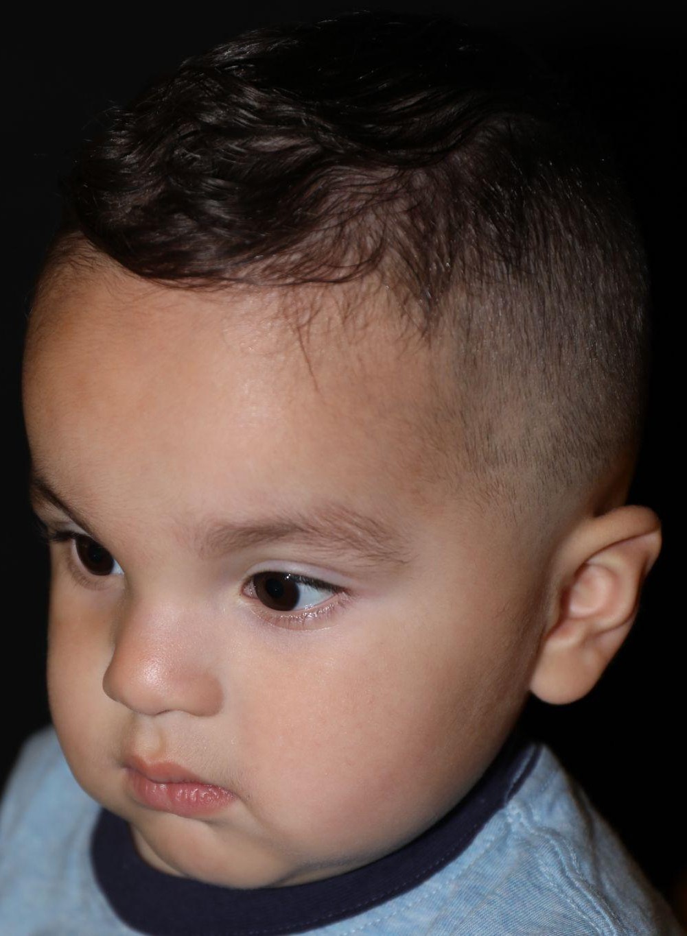 Left angle at Year 2 after treatment - Case 1007