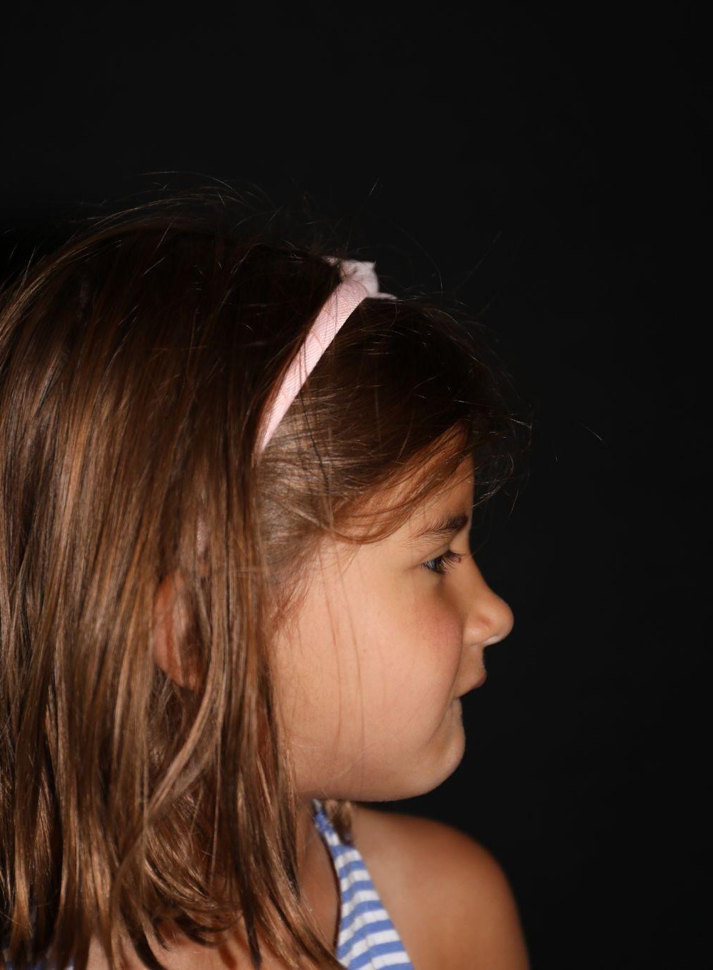 Right profile at Year 4 after treatment - Case 1008