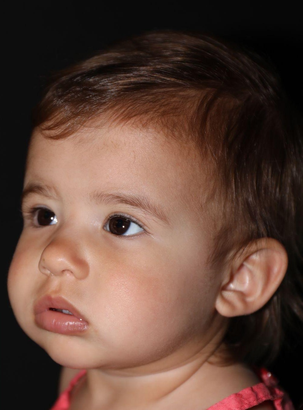 Left angle at Year 2 after treatment - Case 1008
