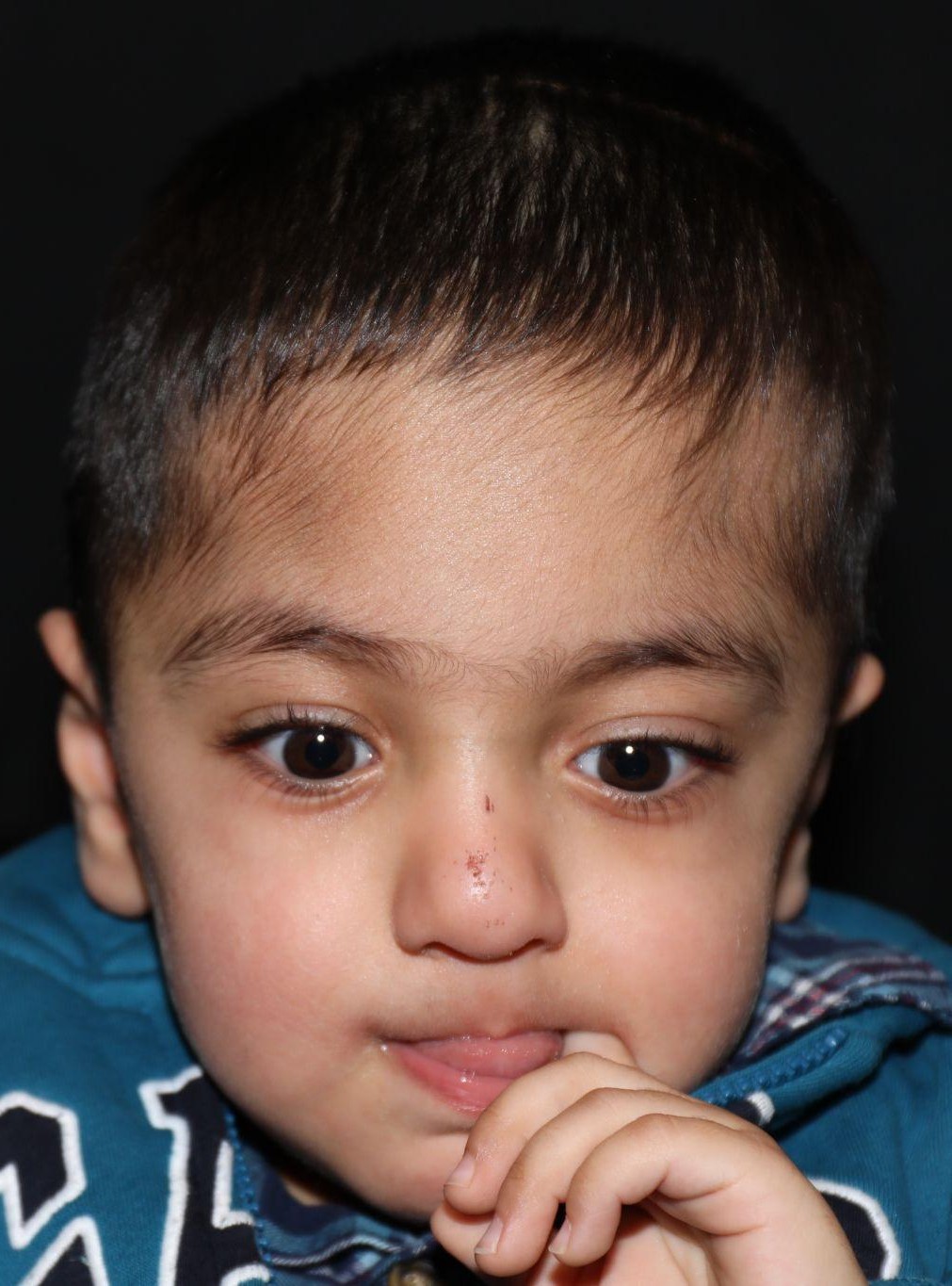 After treatment - Case 1009