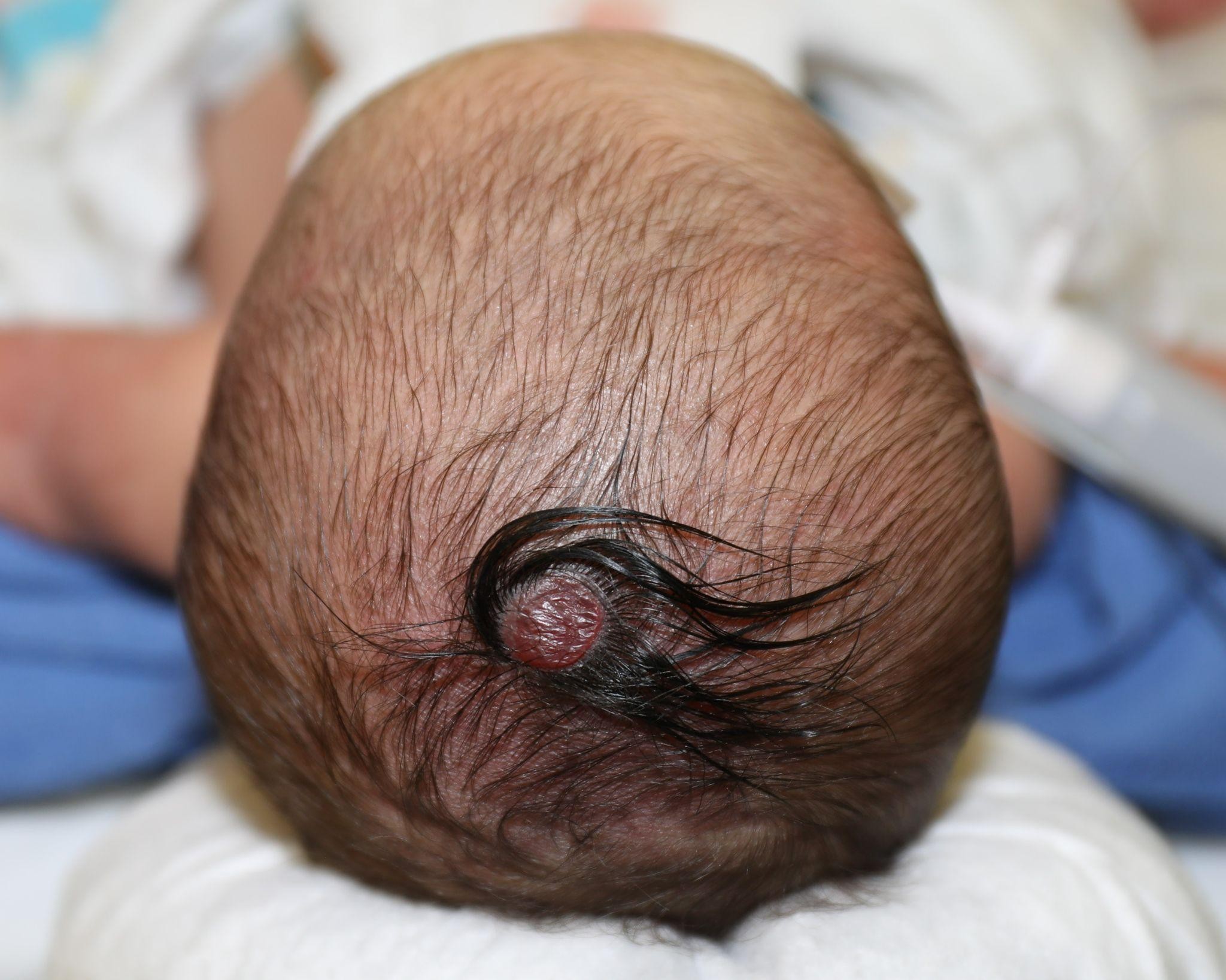 Before treatment - Case 5001