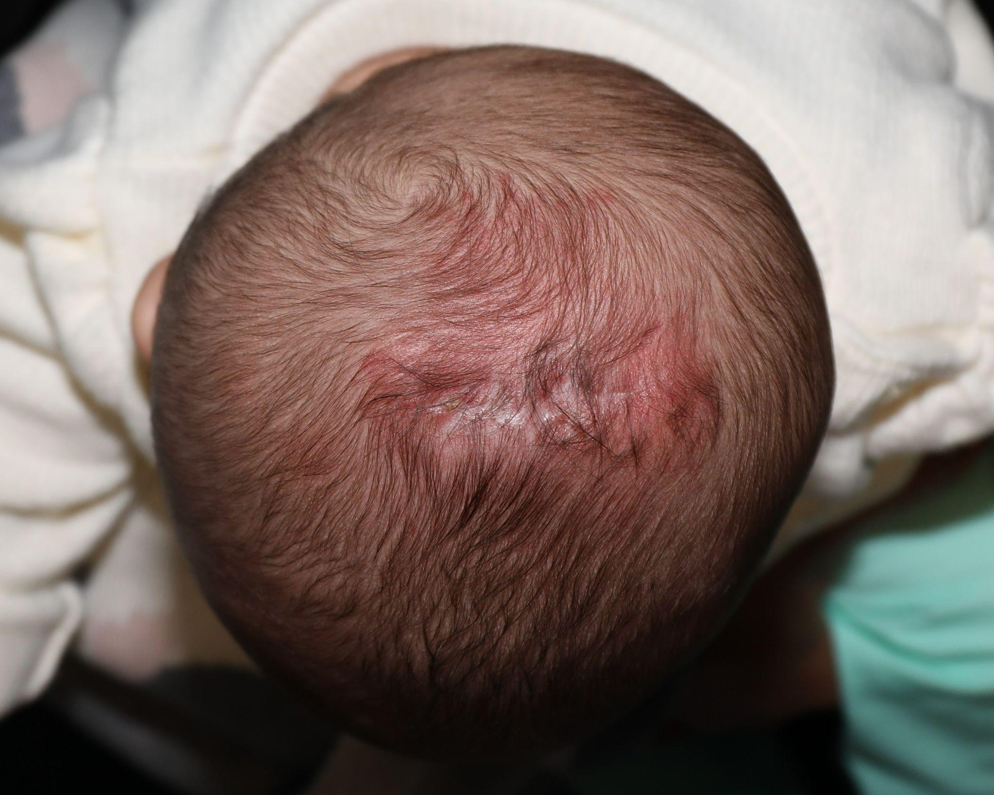 After treatment - Case 5001