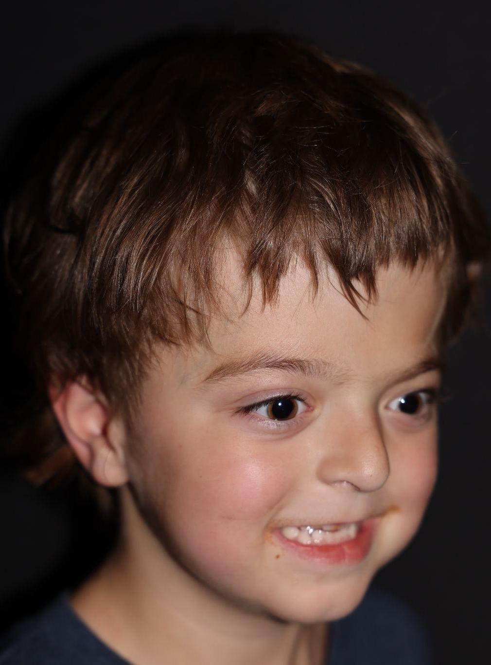 Right angle at Year 3 after treatment - Case 1001