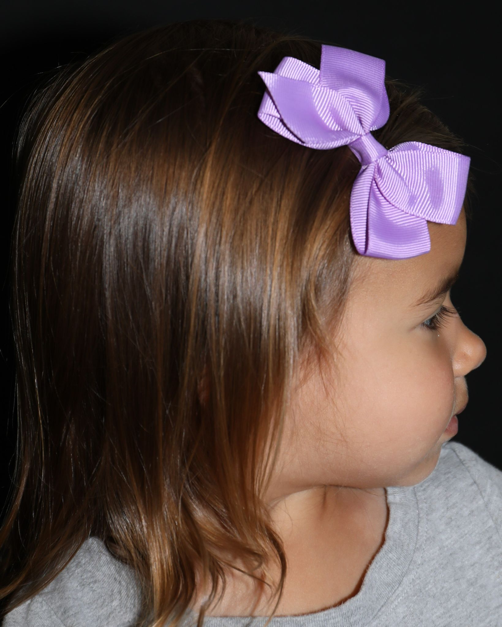 Right profile at Year 3 after treatment - Case 1008