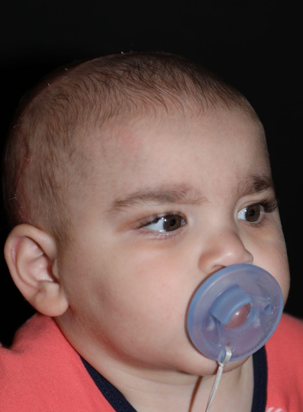 Right angle at Year 2 after treatment - Case 1016
