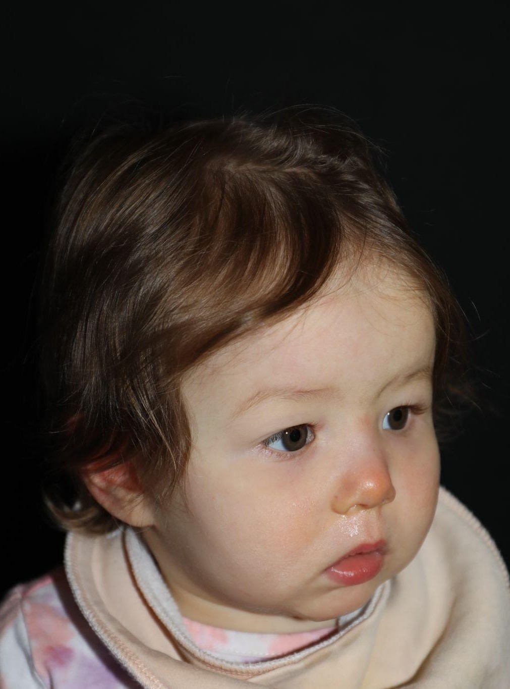 Right angle at Year 2 after treatment - Case 1017