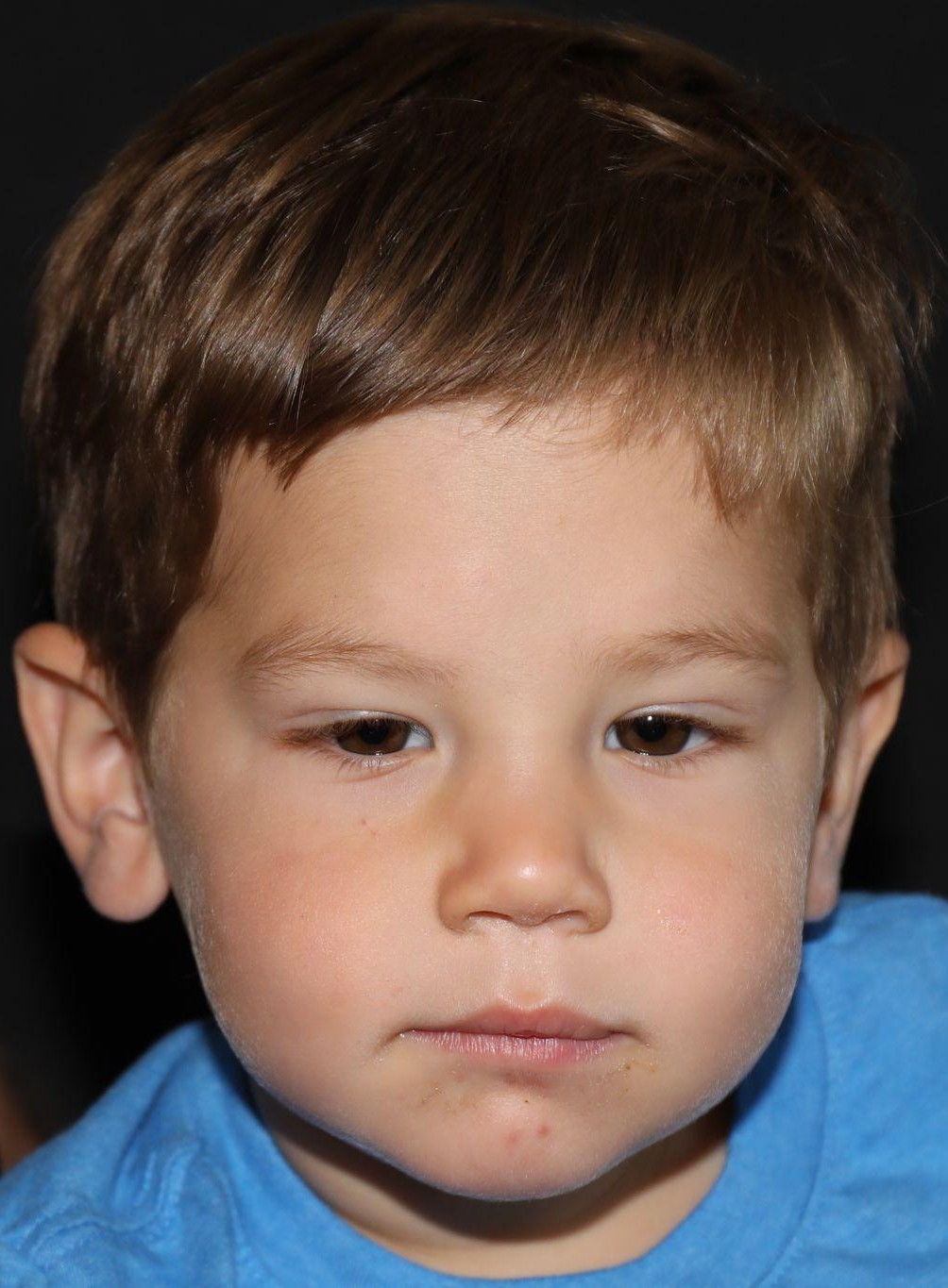 Front view at Year 3 after treatment - Case 1013