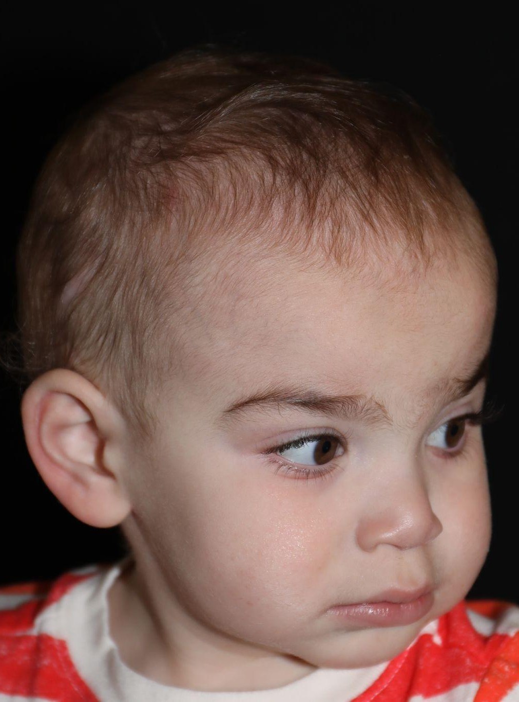 Right angle at Year 3 after treatment - Case 1016