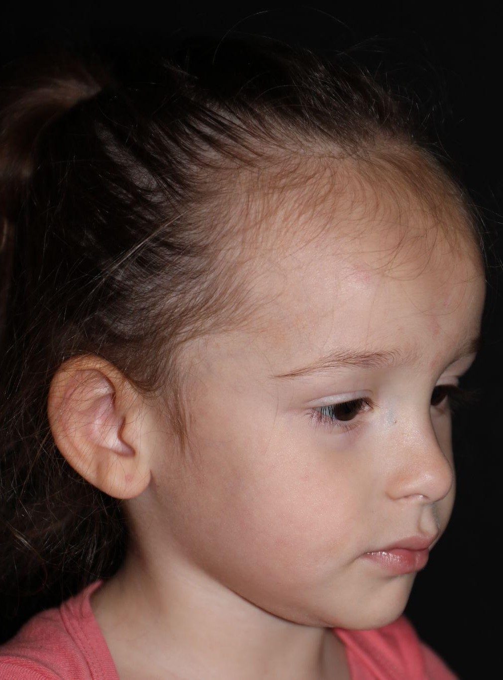 Right angle at Year 3 after treatment - Case 1020