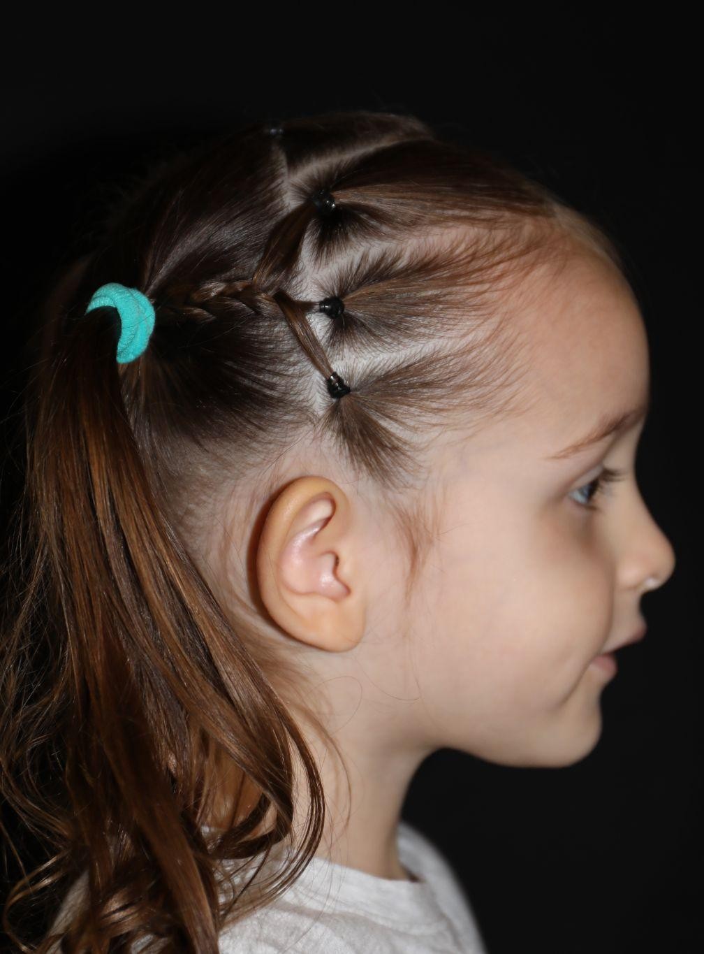 Right profile at Year 4 after treatment - Case 1020