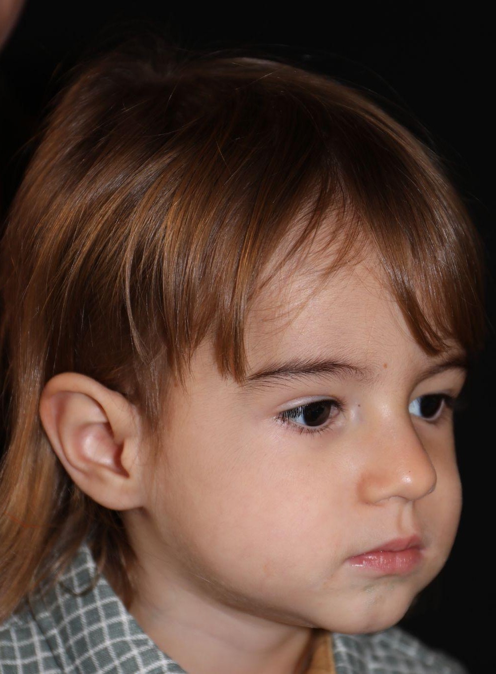 Right angle at Year 5 after treatment - Case 5002