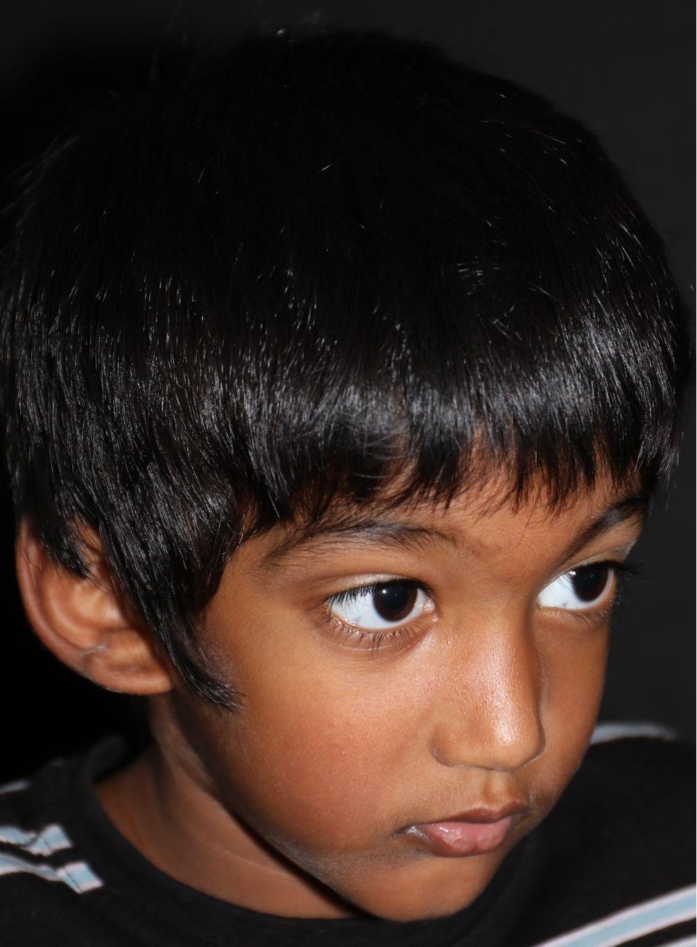 Right angle at Year 3 after treatment - Case 1011